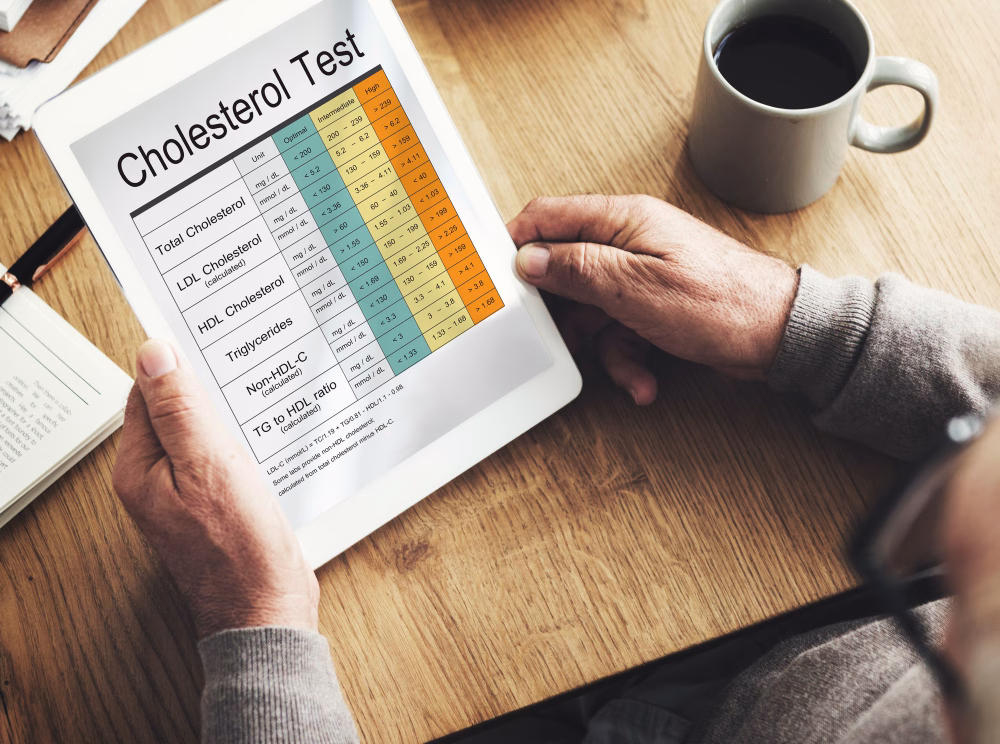High Cholesterol Treatment in Sunnyvale TX